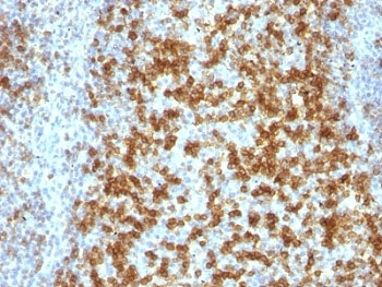 PD-1 Antibody