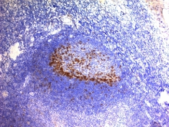 PD1 Antibody