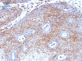 Beta-2 Microglobulin Antibody