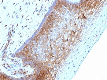 Beta-2 Microglobulin Antibody