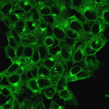 Beta-2 Microglobulin Antibody