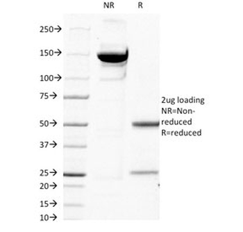 Beta-2 Microglobulin Antibody