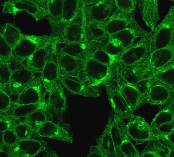 B2M Antibody / Beta-2 Microglobulin