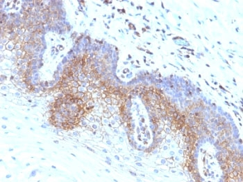 B2M Antibody / Beta-2 Microglobulin