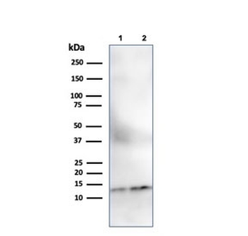B2M Antibody / Beta-2 Microglobulin