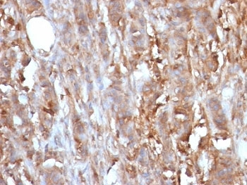 Beta-2 Microglobulin Antibody