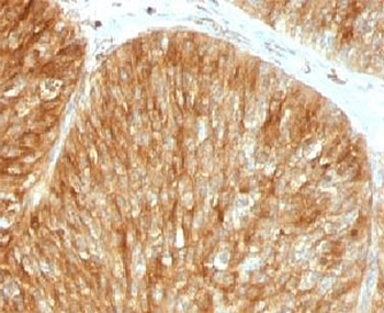 Beta-2 Microglobulin Antibody
