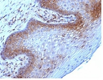 Beta-2 Microglobulin Antibody