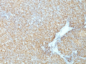 Cyclin D1 Antibody