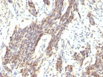 Cyclin D1 Antibody
