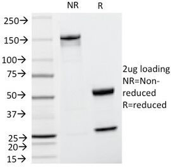 Cyclin D1 Antibody