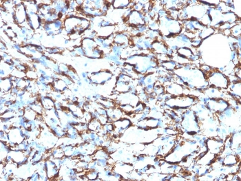 Alpha Actin Antibody Cocktail / ACTA2 (smooth muscle)