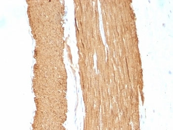 Alpha Actin Antibody Cocktail / ACTA2 (smooth muscle)