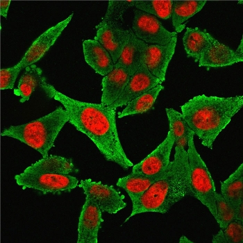 Alpha Actin Antibody Cocktail / ACTA2 (smooth muscle)