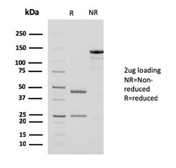 Alpha Actin Antibody Cocktail / ACTA2 (smooth muscle)