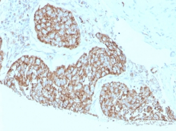 S100A9 Antibody