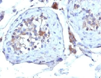 SHBG Antibody