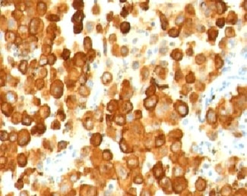 PMEL17 Antibody / Melanoma gp100