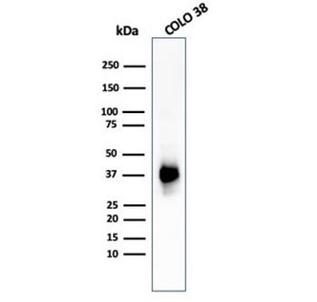 PMEL17 Antibody / Melanoma gp100