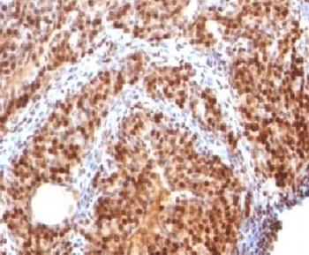 SUMO2 Antibody