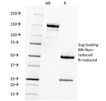 Fascin Antibody