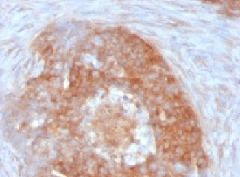 Fascin Antibody