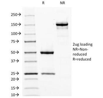 Fascin Antibody