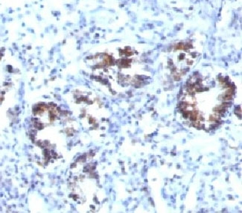 Transgelin Antibody