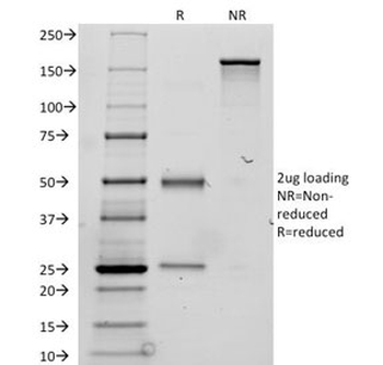 TG Antibody / Thyroglobulin