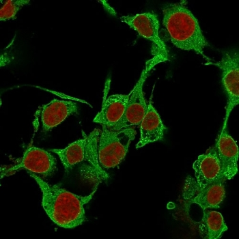 TNF-alpha Antibody