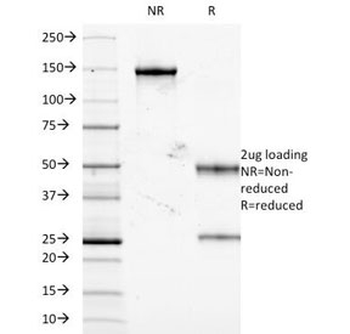 TNF-alpha Antibody