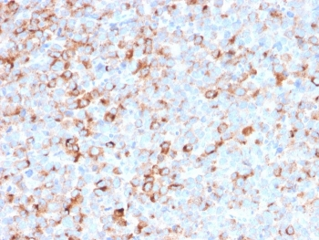 TYR Antibody Cocktail (Tyrosinase)