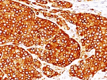 TYR Antibody Cocktail (Tyrosinase)