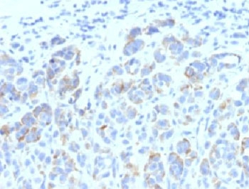 TRP1 Antibody / Tyrosinase-Related Protein-1 Antibody / TYRP1
