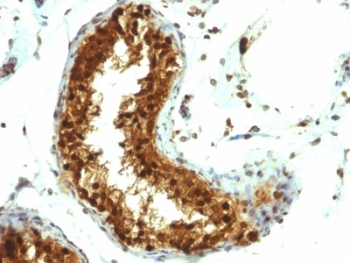 SUMO-1 Antibody