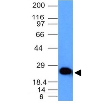 PGP9.5 / UchL1 Antibody