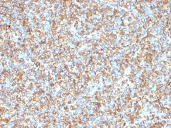 Vimentin Antibody
