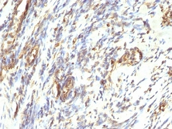 Vimentin Antibody