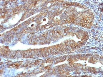 Vimentin Antibody
