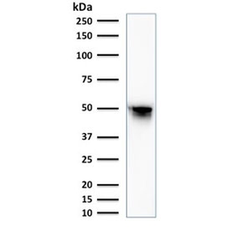 Vimentin Antibody