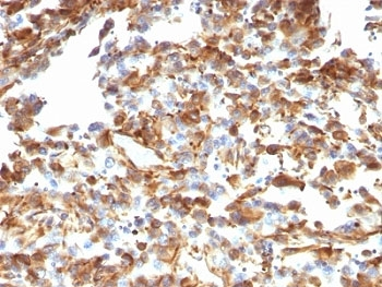 Vimentin Antibody