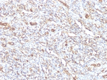 Vimentin Antibody