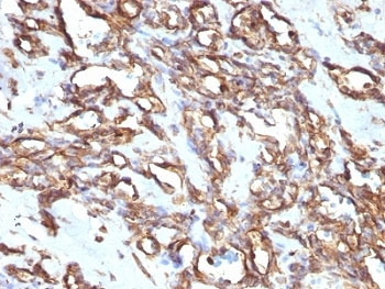 Vimentin Antibody