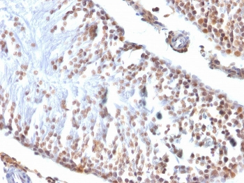 Wilms Tumor 1 Antibody