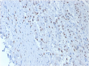 Wilms Tumor 1 Antibody