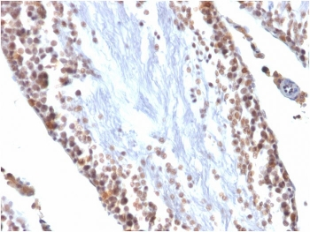 WT1 Antibody