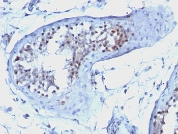 Cyclin B1 Antibody