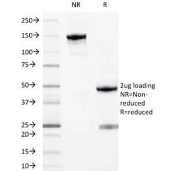 Myeloid Marker / MYADM Antibody