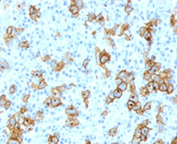 CD30 Antibody