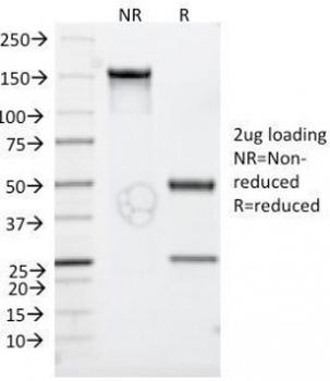 CD30 Antibody